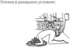 Soviet enema pot with mouth pieces, surplus. The official instructional picture.