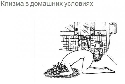 Soviet enema pot with mouth pieces, surplus. The official instructional picture.