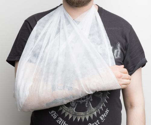 Estecs triangular bandage.