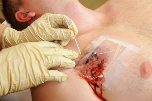 TyTek Medical TPAK needle.